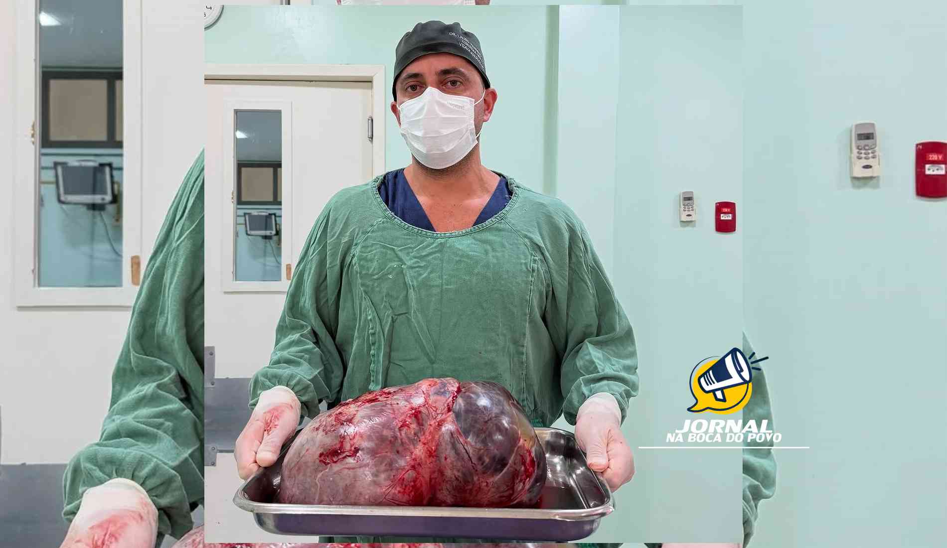 Médico retirar tumor ¨gigante¨ com cerca de 15 kg de paciente